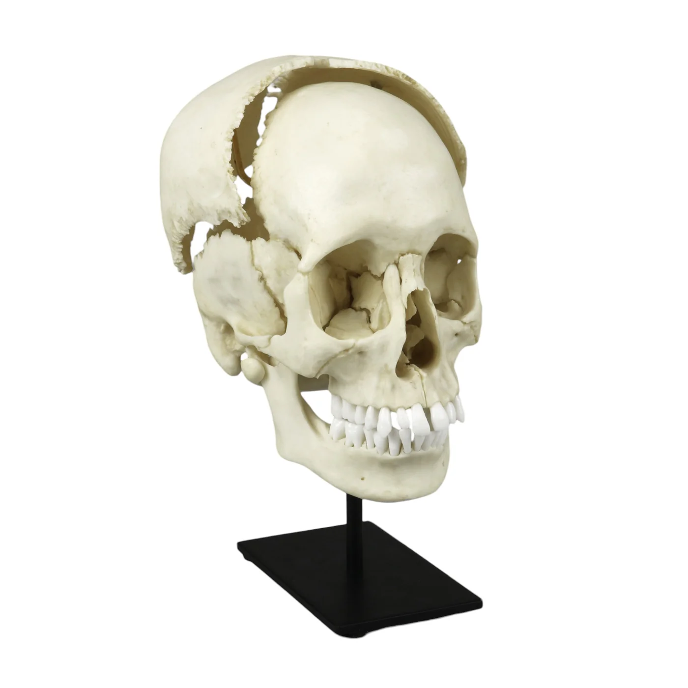 Replica Human Skull Medical Study - Articulated