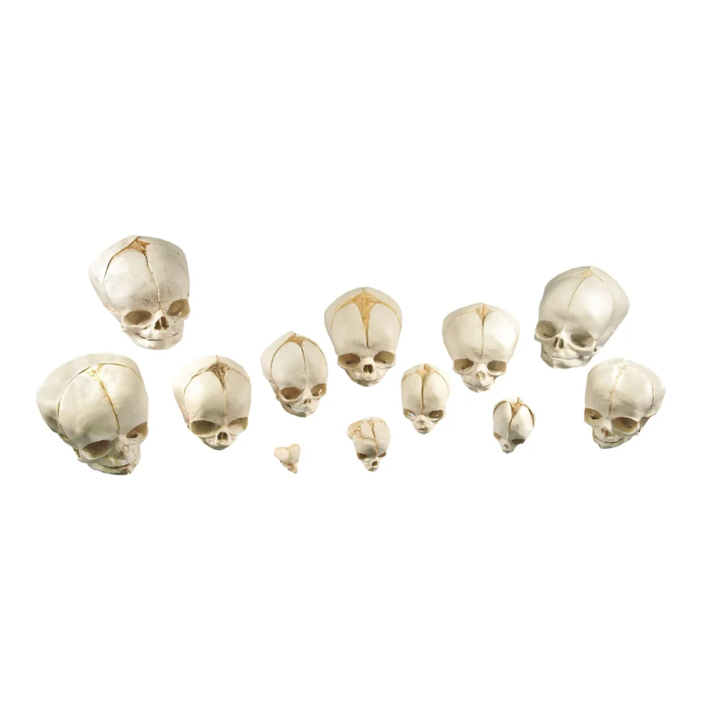 Replica Human Fetal Skull Development Kit - Set of 12