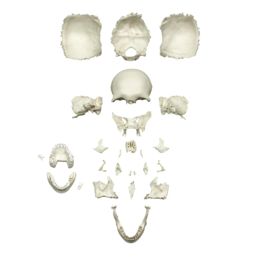Replica Human Medical Study Skull
