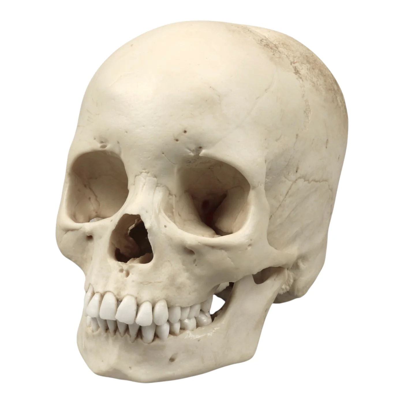 Replica Human Skull - Cribra Orbitalia|Porotic Hyperostosis - Image 3