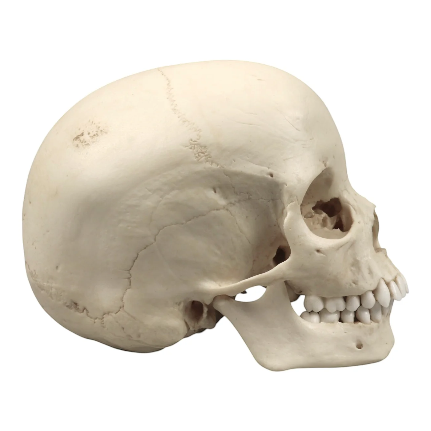 Replica Human Skull - Cribra Orbitalia|Porotic Hyperostosis - Image 4