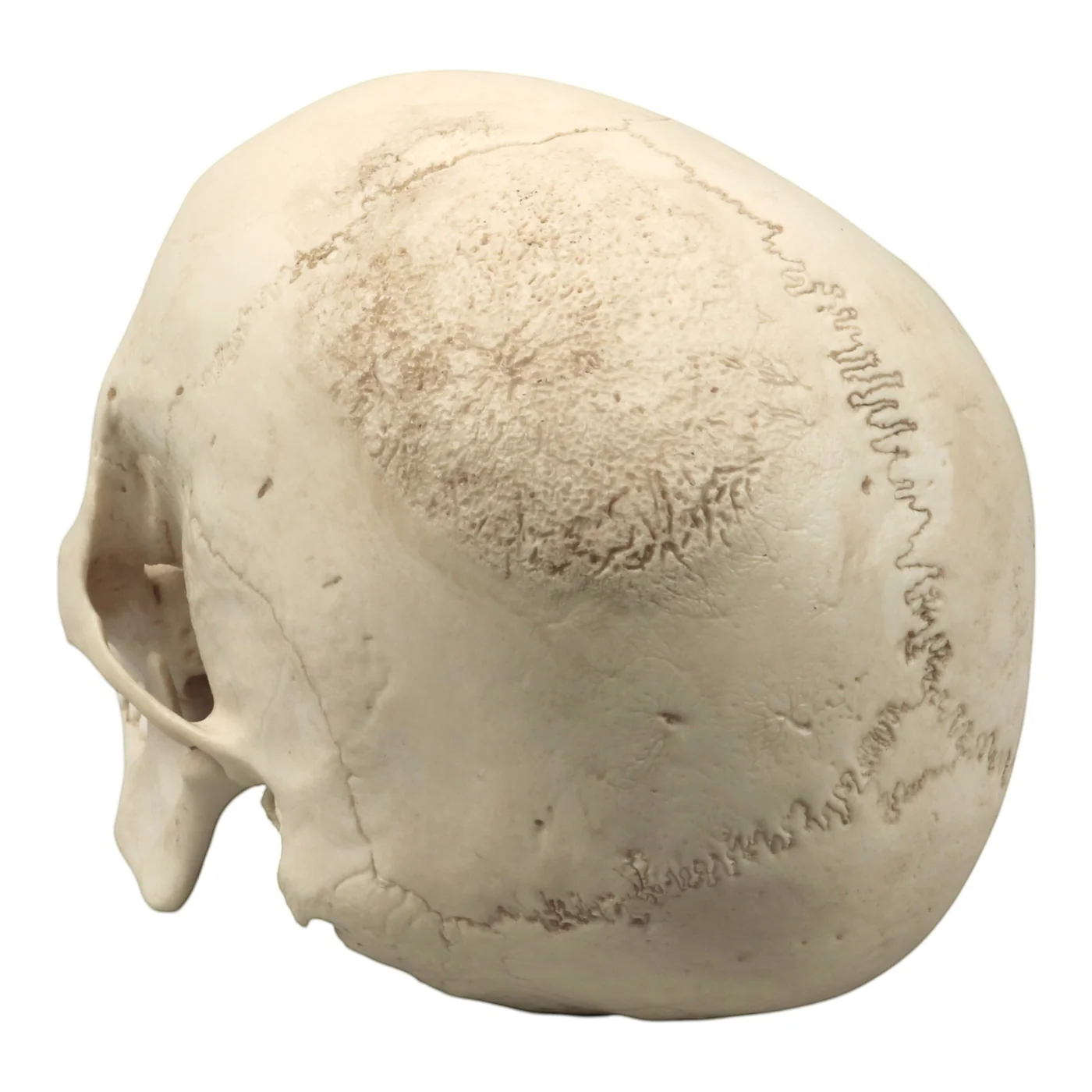 Replica Human Skull - Cribra Orbitalia|Porotic Hyperostosis - Image 5