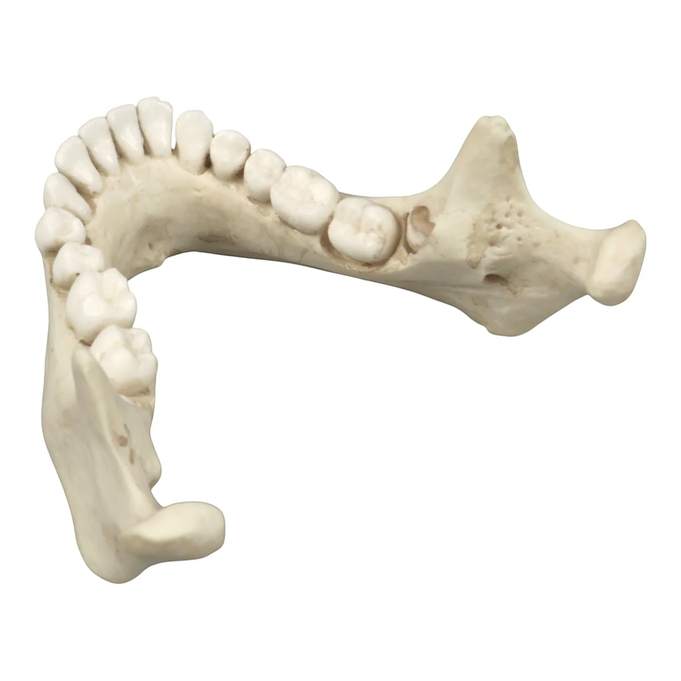 Replica Human Skull - Cribra Orbitalia|Porotic Hyperostosis - Image 6