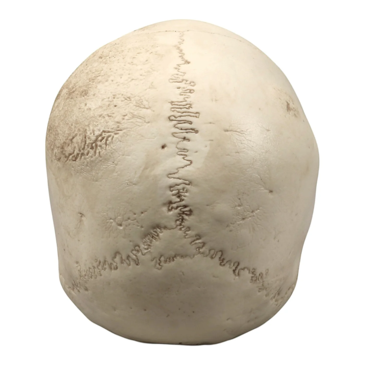 Replica Human Skull - Cribra Orbitalia|Porotic Hyperostosis - Image 7