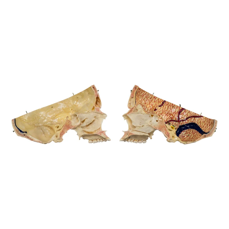 Real Human Dissected Skull in Case - Image 2