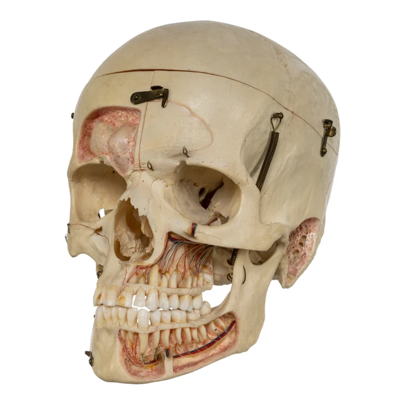 Real Human Dissected Skull in Case - Image 3