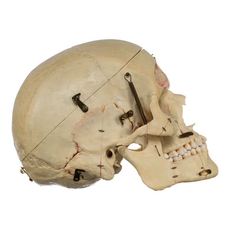 Real Human Dissected Skull in Case - Image 4