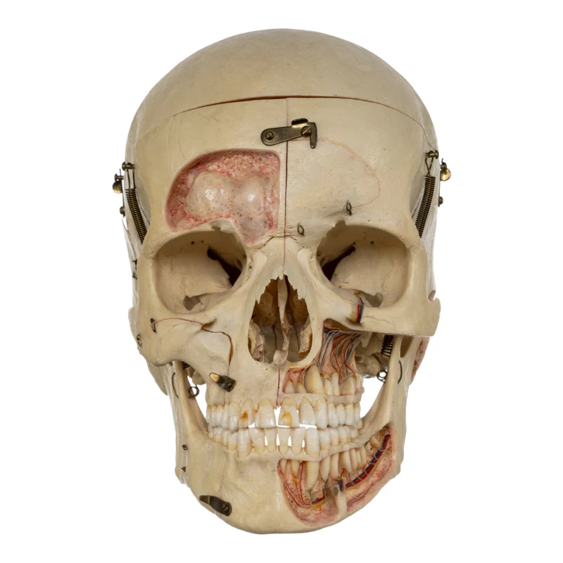 Real Human Dissected Skull in Case - Image 5