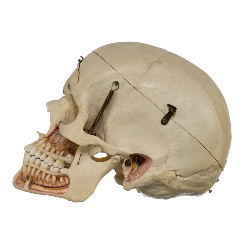 Real Human Dissected Skull in Case - Image 6