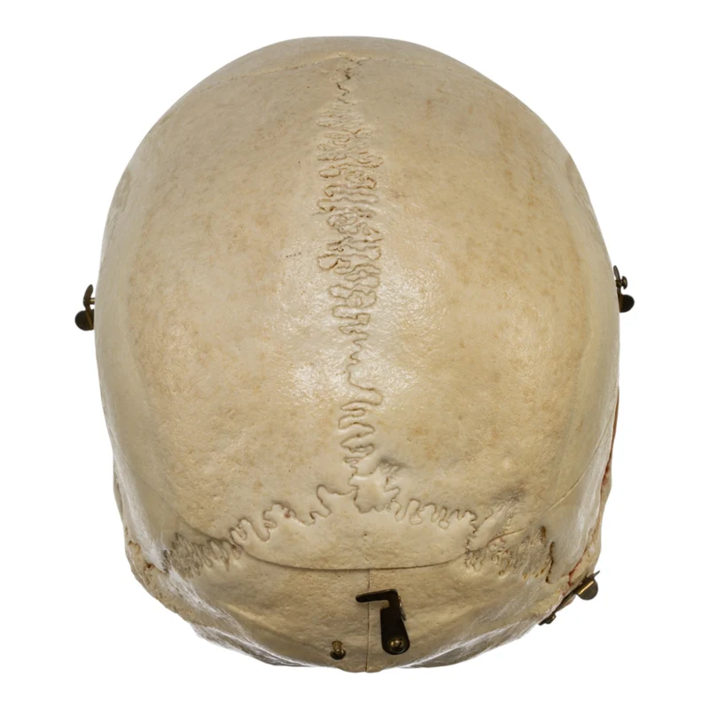 Real Human Dissected Skull in Case - Image 7