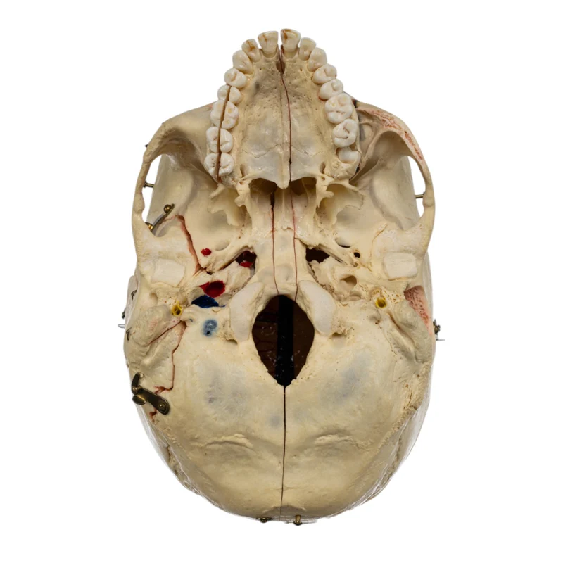 Real Human Dissected Skull in Case - Image 8