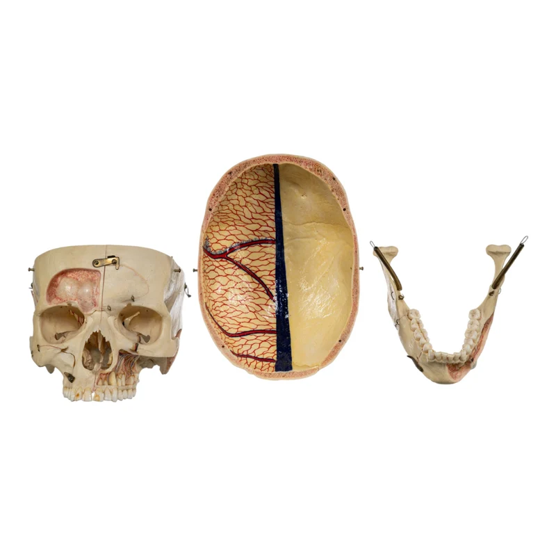 Real Human Dissected Skull in Case - Image 9