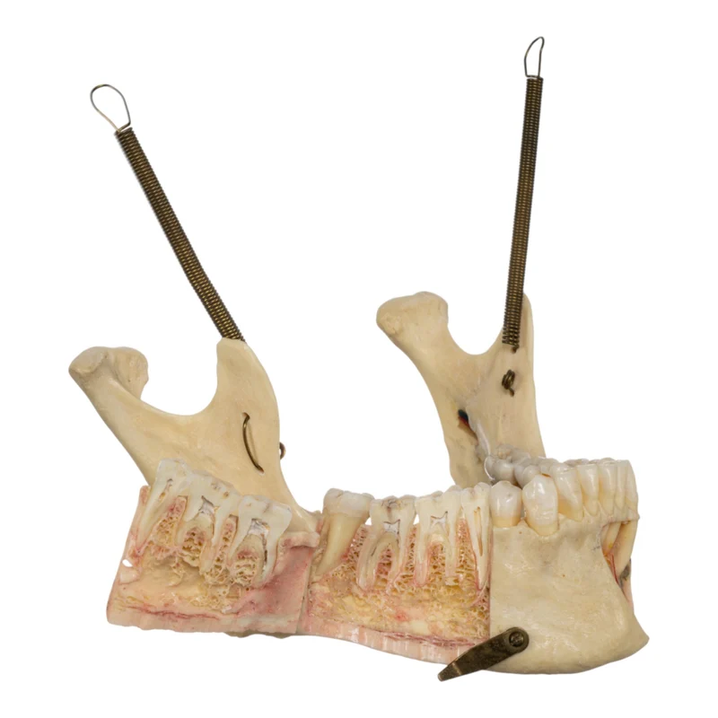 Real Human Dissected Skull in Case - Image 10
