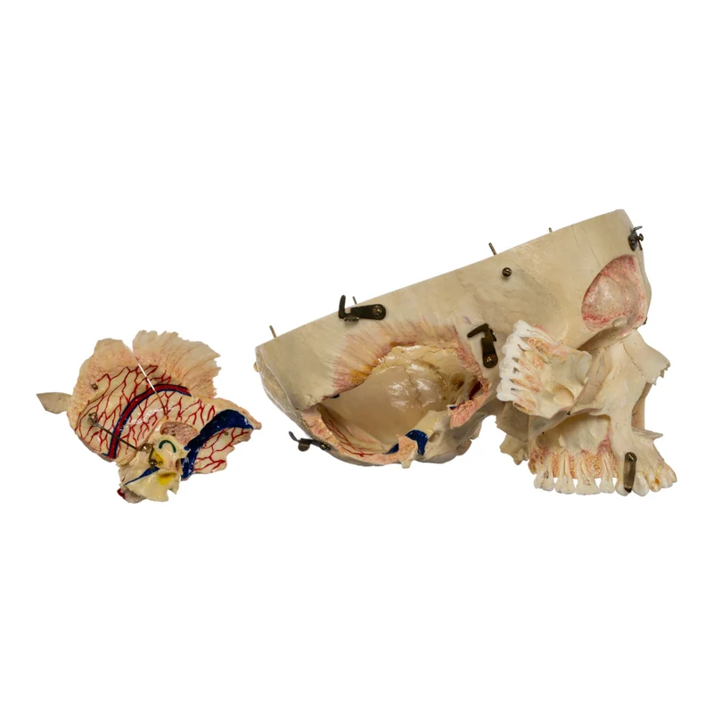 Real Human Dissected Skull in Case - Image 11