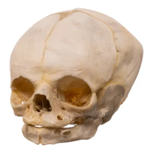 Real Human Fetal Skull -5