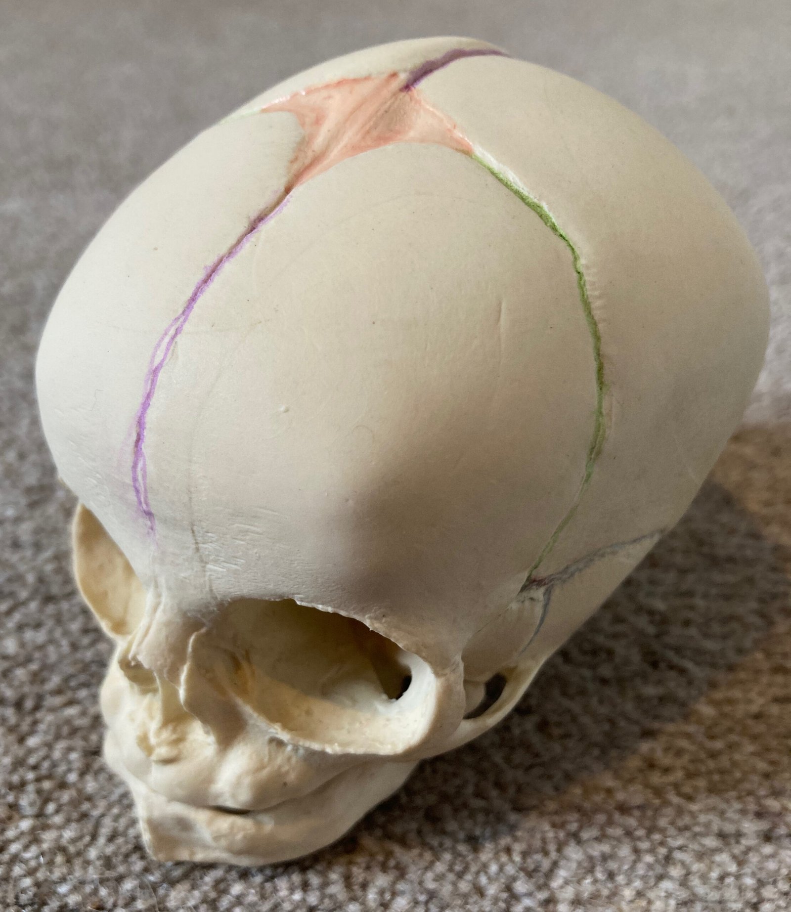baby skull