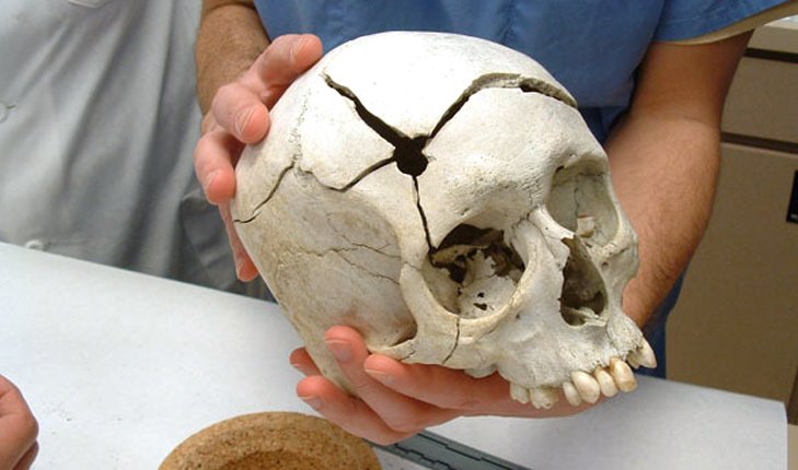 forensic anthropology