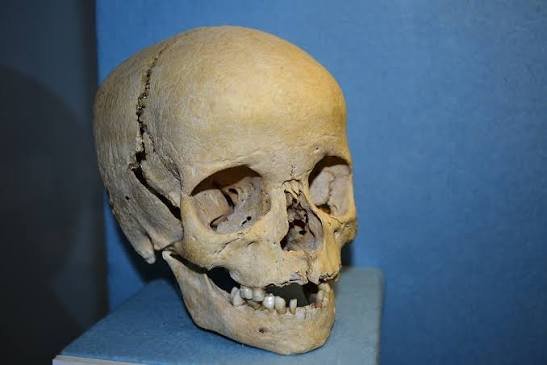 authentic human skull